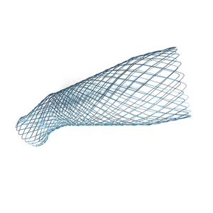 Customized Metal Stents 