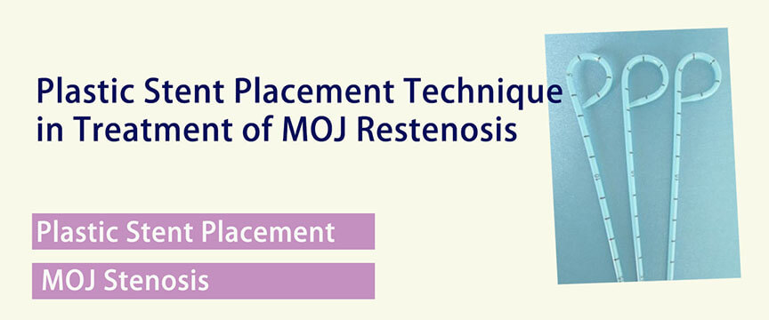 Plastic Stent Placement Techniquein Treatment of MOJ Restenosis