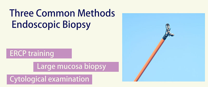 Three Common Methods of Endoscopic Biopsy and Cytology