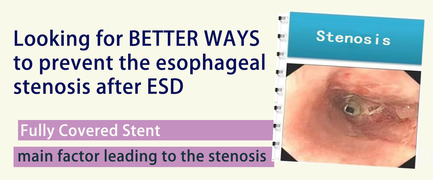 Looking for BETTER WAYS to prevent the esophageal stenosis after ESD