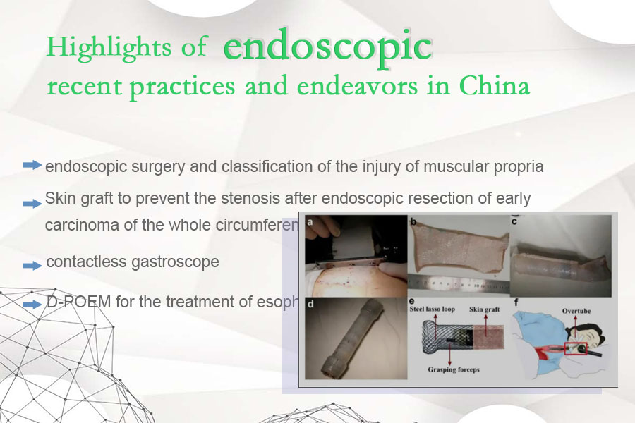 Highlights of endoscopic practices and endeavors in China 2020